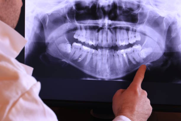 Best Emergency Treatment for Dental Infections or Abscesses in Ocean City, MD